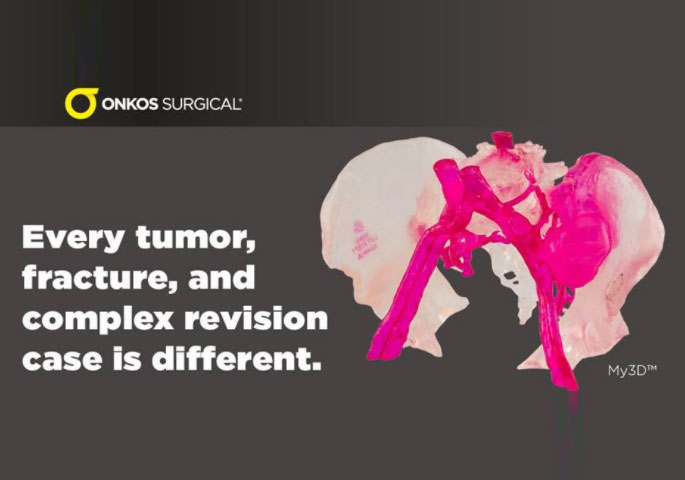 3D Systems的VSP骨科虛擬手術規(guī)劃平臺獲得FDA許可