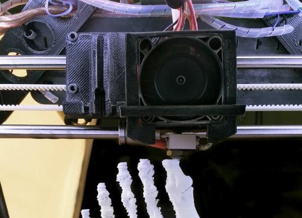 西南地區(qū)首例！四川省人民醫(yī)院為患者裝上3D打印半骨盆