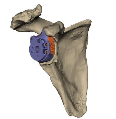 1662620563104490.jpg a2.jpg