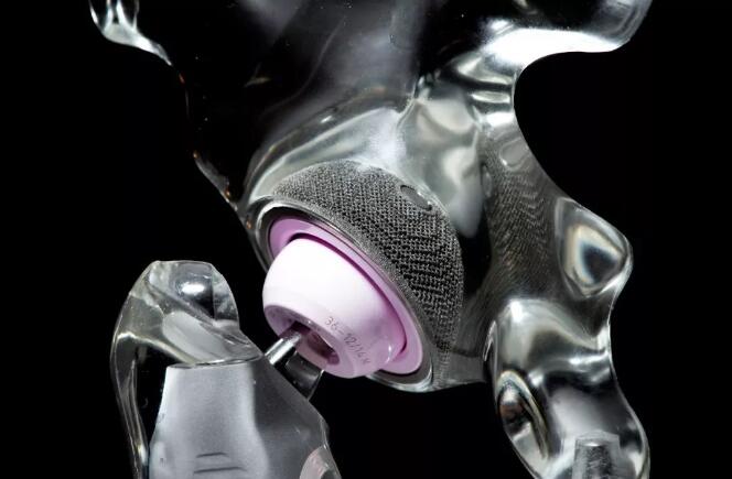 幾十萬個案例，3D打印髖臼杯走過十多年歷史