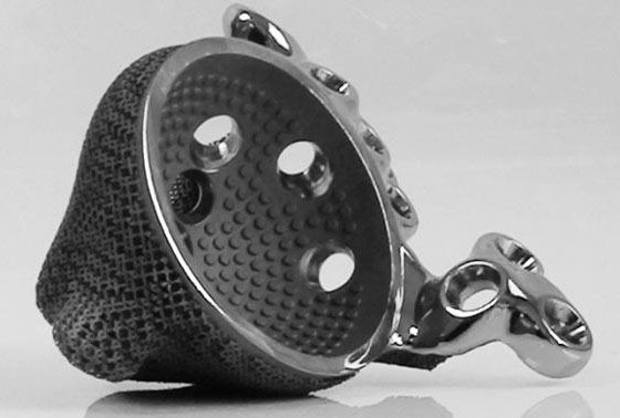 列舉國內(nèi)在醫(yī)學3D打印金屬材料領(lǐng)域發(fā)力的企業(yè)